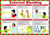 SSP External Bleeding Laminated Safety Poster